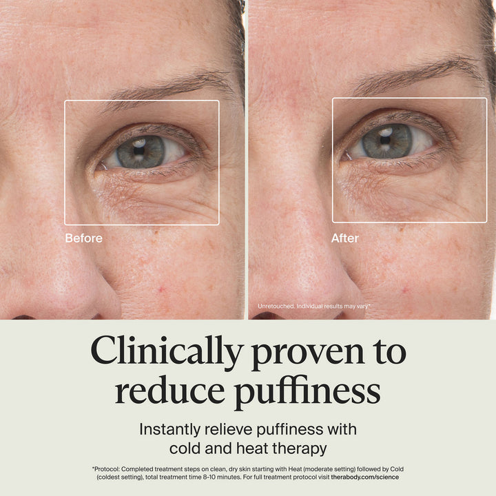 Therabody | TheraFace Depuffing Wand - Indigo | TF0004132-2A40